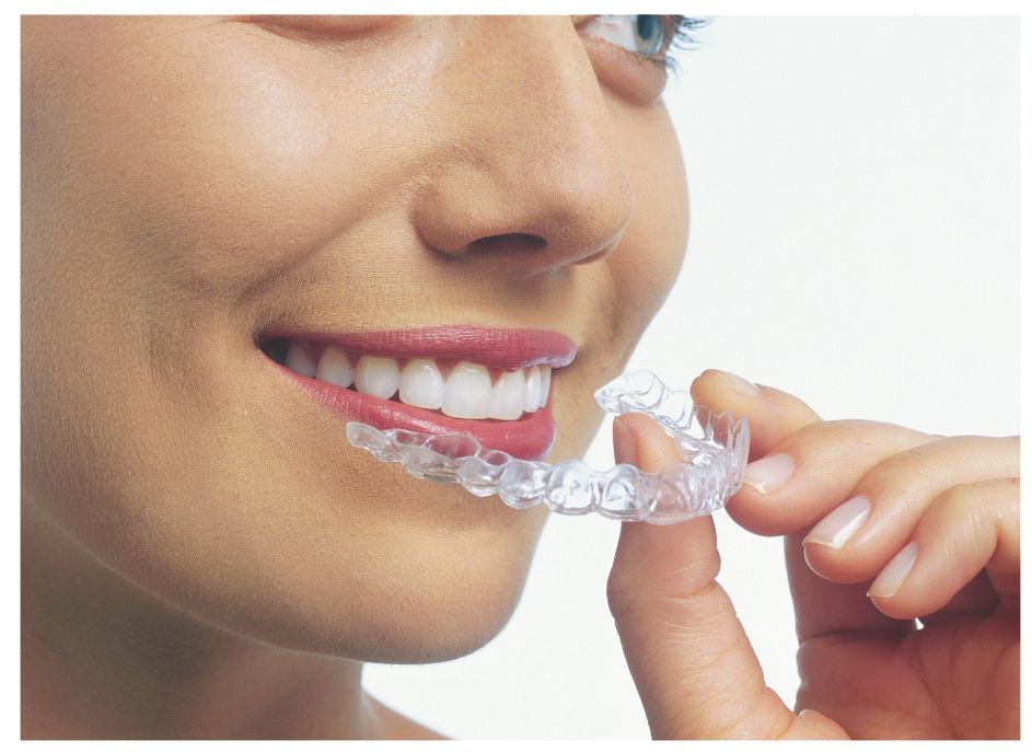 About Invisalign for Teens