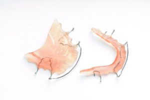 Image of Hawley retainer