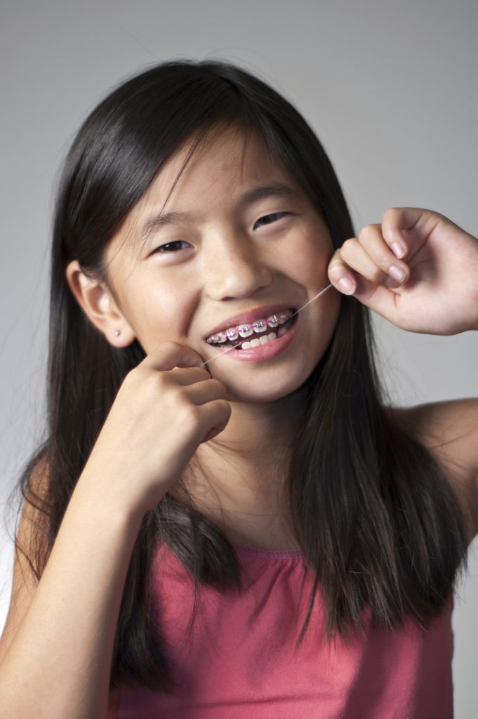 Girl with braces flossing teeth